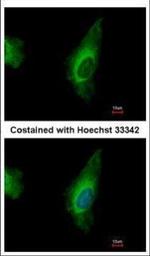 ORP8 Polyclonal Antibody