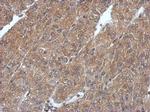 PHYHIP Polyclonal Antibody