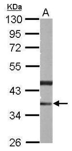 PHYHIP Antibody in Western Blot (WB)