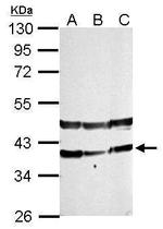 PHYHIP Antibody in Western Blot (WB)