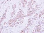 PSD4 Polyclonal Antibody