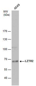 LZTR2 Antibody in Western Blot (WB)