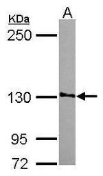 SMG7 Antibody in Western Blot (WB)