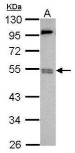 BRD9 Antibody in Western Blot (WB)