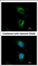 DUS2L Polyclonal Antibody