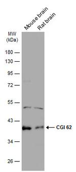 CGI-62 Antibody in Western Blot (WB)