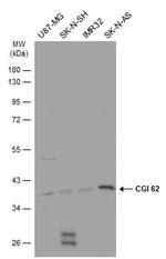 CGI-62 Antibody in Western Blot (WB)