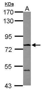 FBXO21 Polyclonal Antibody