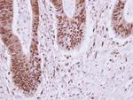 ELP2 Antibody in Immunohistochemistry (Paraffin) (IHC (P))