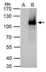 ELP2 Antibody in Immunoprecipitation (IP)