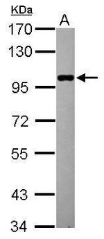ELP2 Antibody in Western Blot (WB)