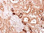 S100A2 Antibody in Immunohistochemistry (Paraffin) (IHC (P))
