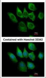 S100A6 Antibody in Immunocytochemistry (ICC/IF)