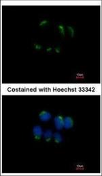 TFF1 Polyclonal Antibody