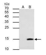 Galectin 7 Antibody in Immunoprecipitation (IP)