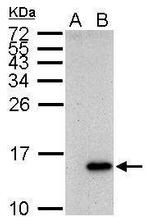 Galectin 7 Polyclonal Antibody