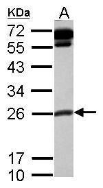 COMMD10 Antibody in Western Blot (WB)