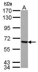 FEM1C Antibody in Western Blot (WB)