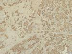 RHAMM Polyclonal Antibody