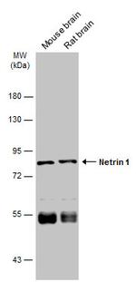 LRRC4C Antibody in Western Blot (WB)
