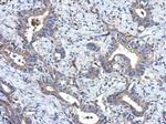 MRPL18 Polyclonal Antibody