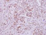NAPRT1 Antibody in Immunohistochemistry (Paraffin) (IHC (P))