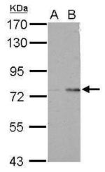 POLR3E Polyclonal Antibody