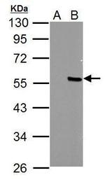 PPP4R2 Polyclonal Antibody