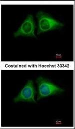 RASA4 Polyclonal Antibody