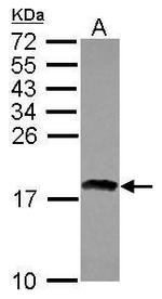 RAX2 Polyclonal Antibody