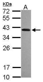 RFPL2 Polyclonal Antibody