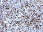 SERPINB7 Antibody in Immunohistochemistry (Paraffin) (IHC (P))