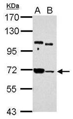 STS1 Antibody in Western Blot (WB)