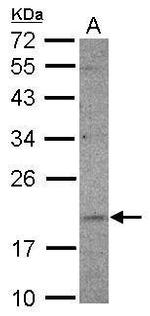 UFC1 Polyclonal Antibody
