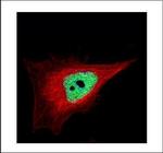 ZNF302 Polyclonal Antibody