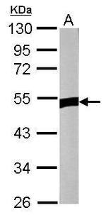 ZNF322A Antibody in Western Blot (WB)