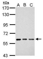 ZNF649 Antibody in Western Blot (WB)