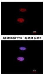 Phospho-Histone H1.4 (Ser35) Polyclonal Antibody