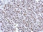 Histone H1.4 Polyclonal Antibody