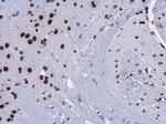 H3K9me3 Antibody in Immunohistochemistry (Paraffin) (IHC (P))