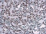 H3K9me3 Antibody in Immunohistochemistry (Paraffin) (IHC (P))