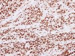 H3K4me2 Antibody in Immunohistochemistry (Paraffin) (IHC (P))