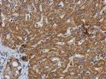 SMYD3 Antibody in Immunohistochemistry (Paraffin) (IHC (P))
