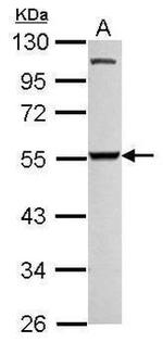 SMYD3 Antibody in Western Blot (WB)