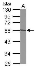 GTDC1 Antibody in Western Blot (WB)