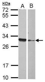 HMGB4 Polyclonal Antibody