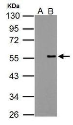 PPP4R2 Antibody in Western Blot (WB)