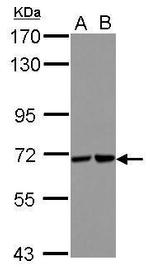 STS1 Polyclonal Antibody