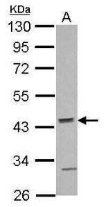 ACTR10 Polyclonal Antibody