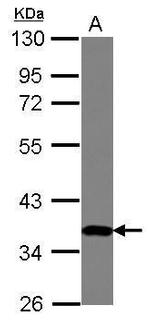 ZNF177 Polyclonal Antibody